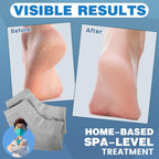 TEAWOO Moisturizing Heel Socks - 6 Pairs for Dry Cracked Feet | Toeless Gel Socks for Hydration and Repair, Soften and Hydrate Dry Cracked Feet Heels, Gel Socks for Dry Cracked Feet