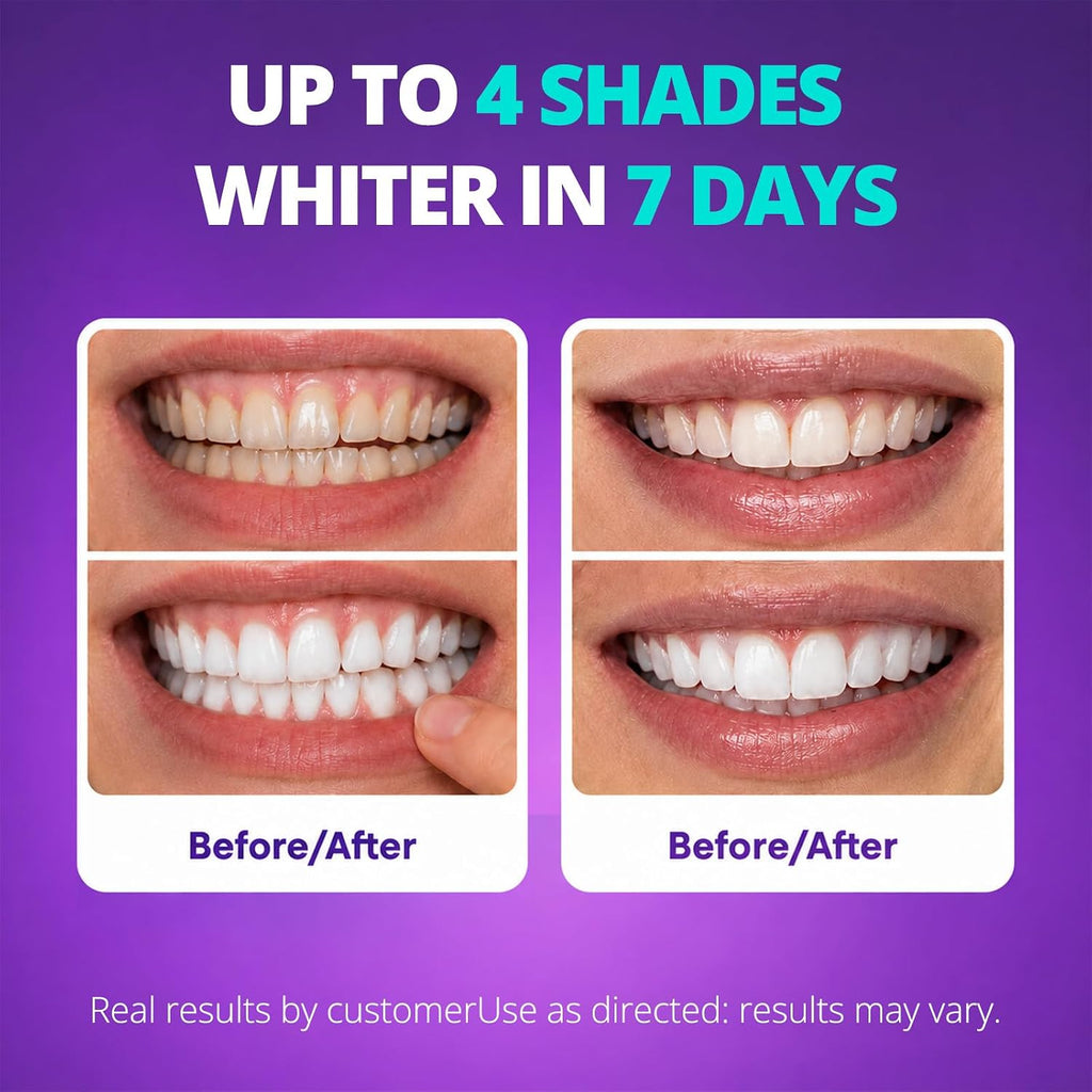 SAKYPRORAL Whitening Strips, Long-Lasting Results, Enamel Safe & Low-Sensitivity, Purple Tooth whitening, Professional Teeth Whitening Strips with Non-Slip Dry Strip Technology, 14 Count (Pack of 1)