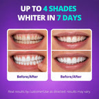 SAKYPRORAL Whitening Strips, Long-Lasting Results, Enamel Safe & Low-Sensitivity, Purple Tooth whitening, Professional Teeth Whitening Strips with Non-Slip Dry Strip Technology, 14 Count (Pack of 1)