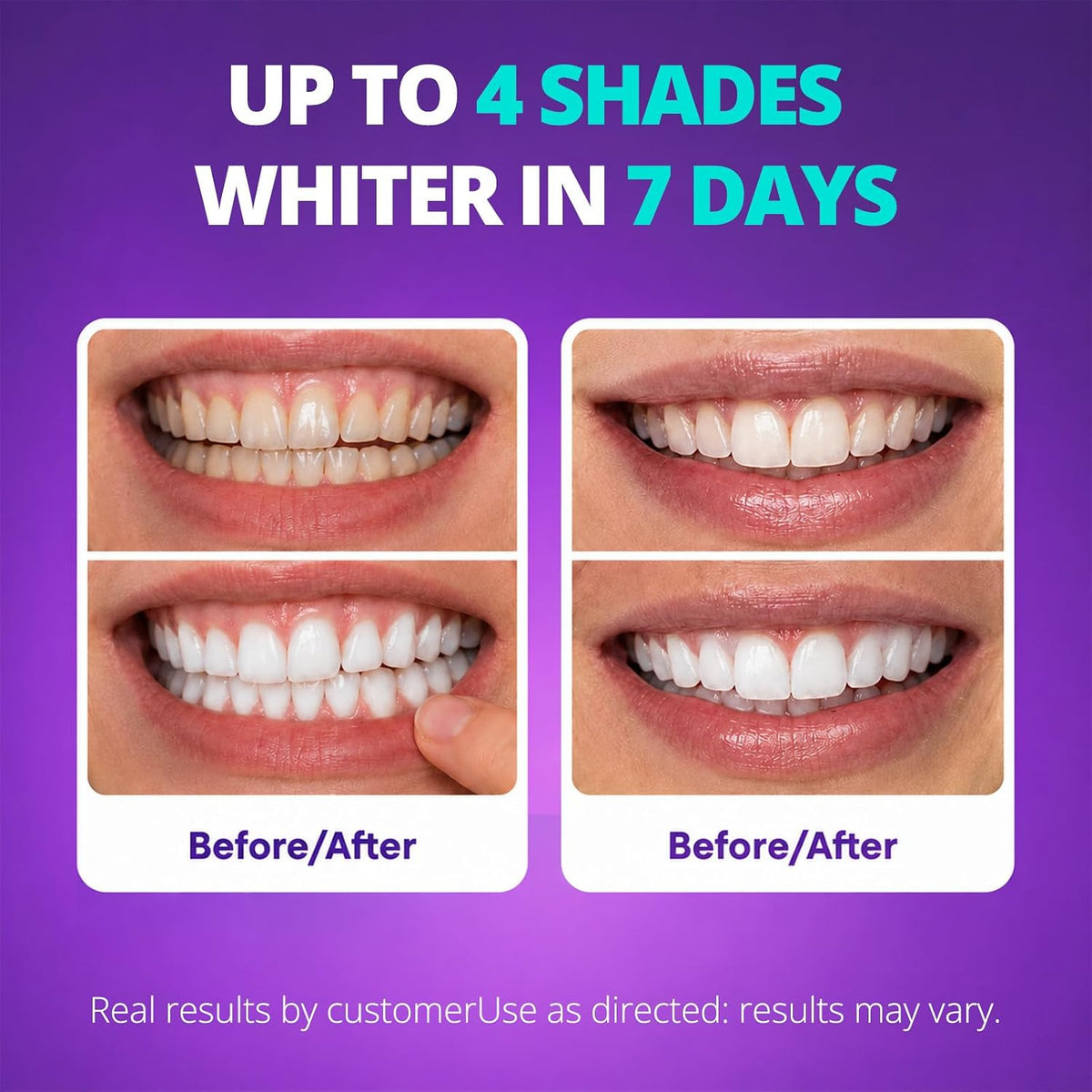 SAKYPRORAL Whitening Strips, Long-Lasting Results, Enamel Safe & Low-Sensitivity, Purple Tooth whitening, Professional Teeth Whitening Strips with Non-Slip Dry Strip Technology, 14 Count (Pack of 1)