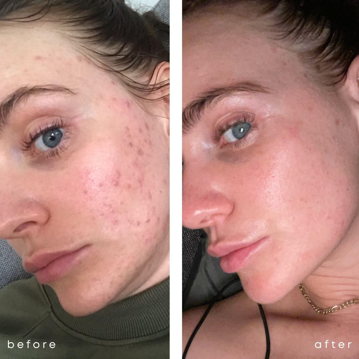Skin Dietary Supplements