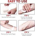 Transparent Film Dressing 4" x 4.75" (10 Pack) - Waterproof Adhesive Wound Bandages for Post-Surgical Shower, IV Shield, Tattoo Aftercare, Clear Breathable Dressing Patches by HEALQU