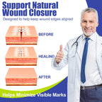 Wound Closure Strips for Skin, 40 Pack Stitchless Skin Closure Device, Alternative to Stitches for Cuts & Lacerations, Butterfly Bandages for Wound Closure, Waterproof & Breathable