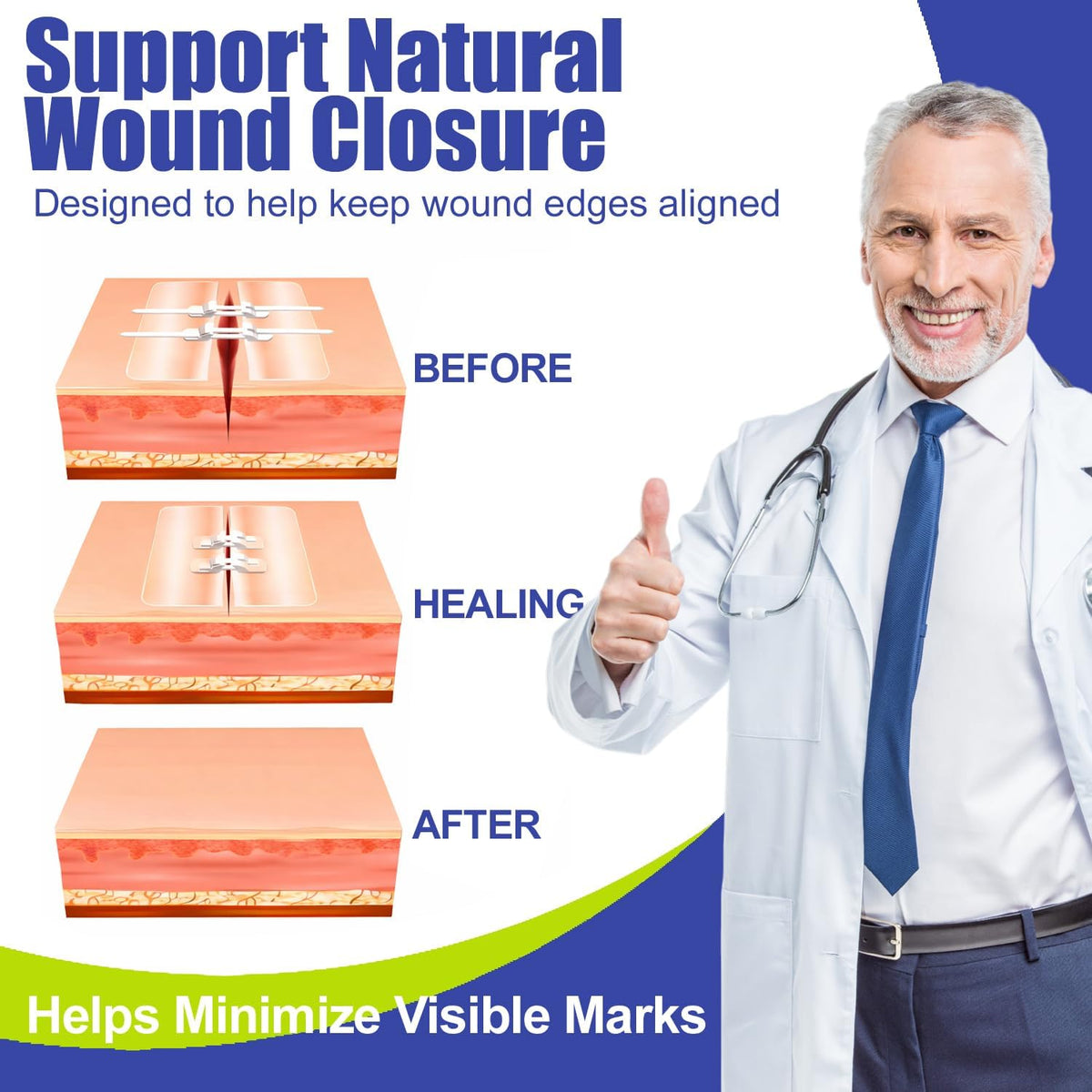 Wound Closure Strips for Skin, 40 Pack Stitchless Skin Closure Device, Alternative to Stitches for Cuts & Lacerations, Butterfly Bandages for Wound Closure, Waterproof & Breathable