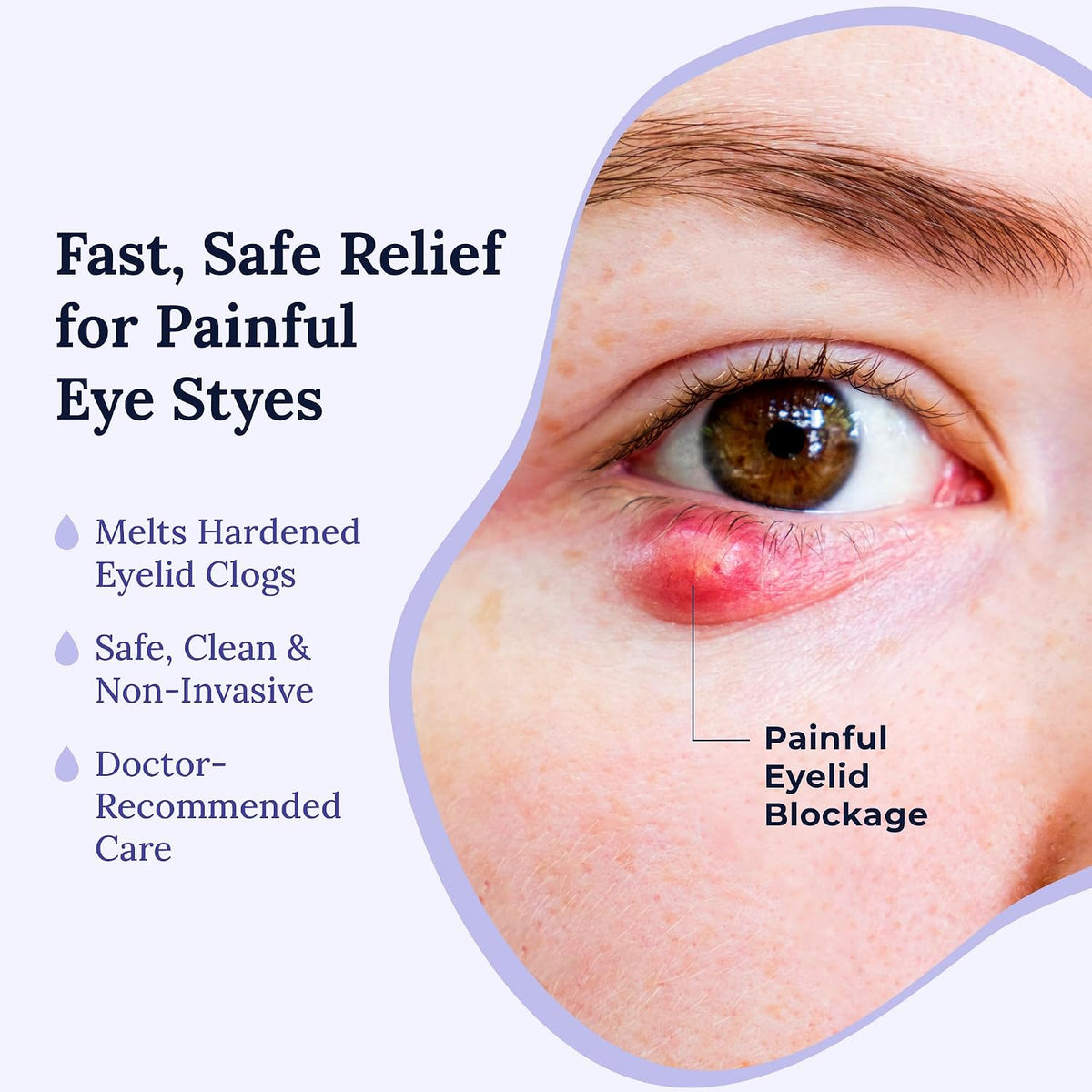 CorneaCare Rest Self Heating Warm Compress for Dry, Tired Eyes | 30 Count | Travel Ready Tired Eye Relief Anywhere | No Microwave Needed | Stye Eye Treament to Soothe Redness, Irritation & Puffiness