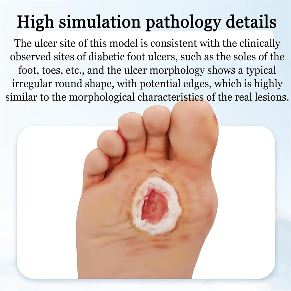 Diabetiker Wound Dressings and Gauze