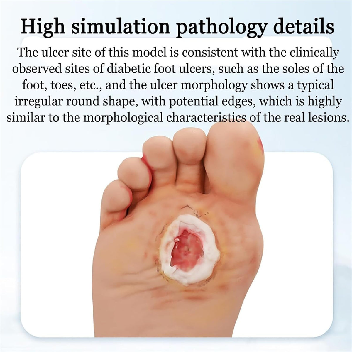 Diabetiker Wound Dressings and Gauze