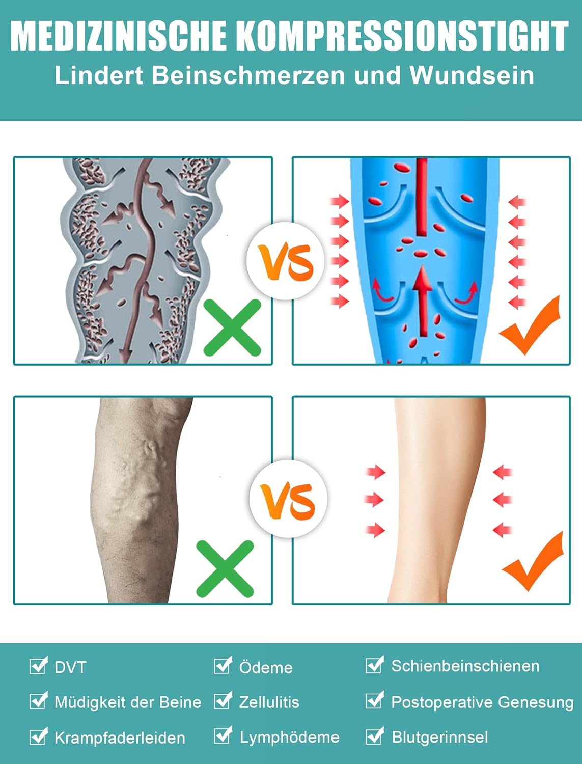Compression Socks 20 mm