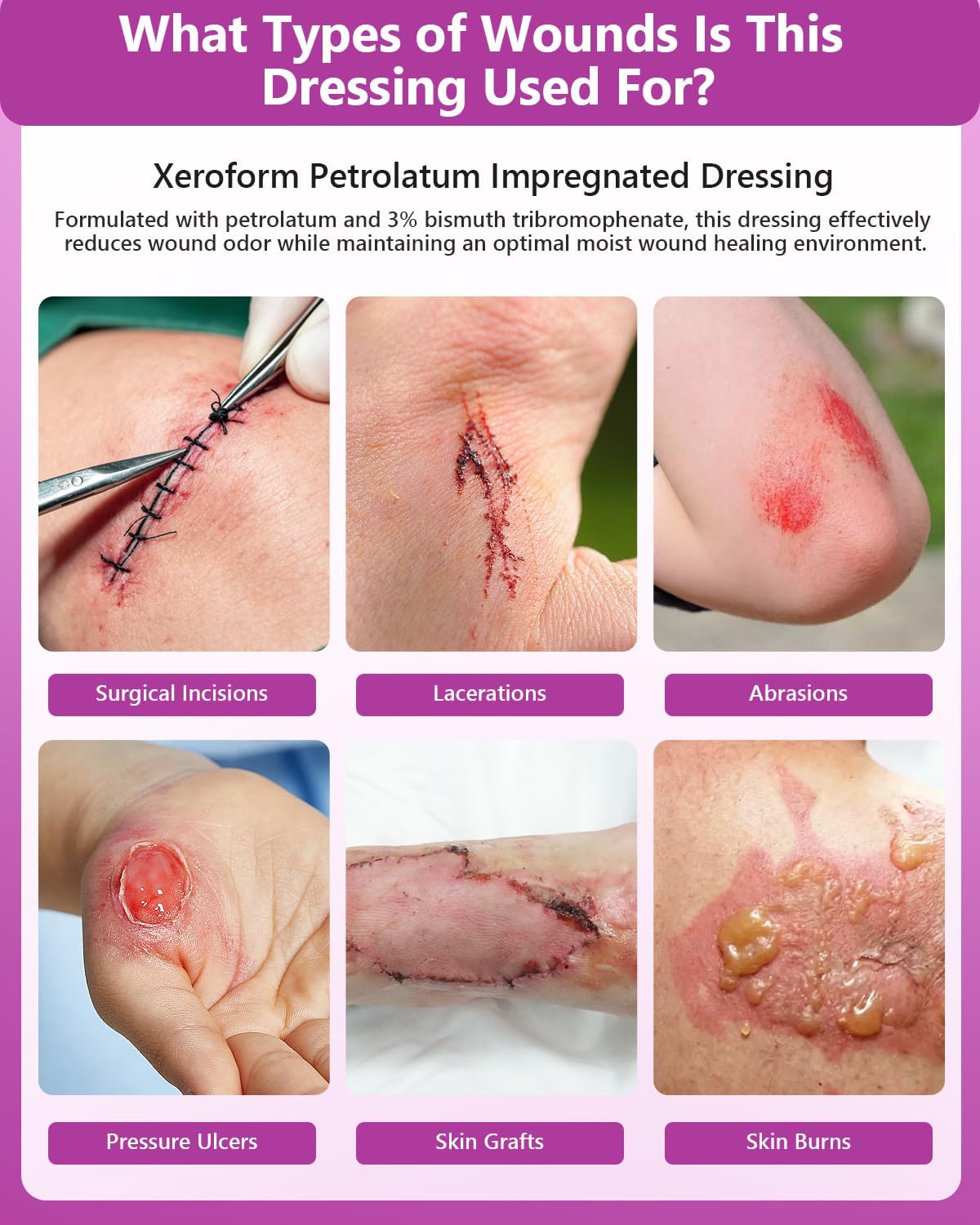 Xeroform Petrolatum Dressing 2"x2" Pack of 25, Non Stick Pads for Wounds, Non-Adherent Gauze, Fine Mesh Sterile for Wound Care, Burns, Lacerations, Skin Grafts & Surgical Incisions