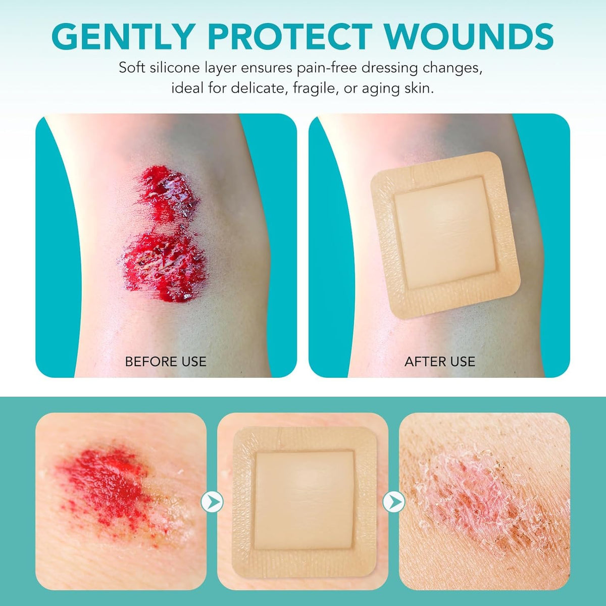 Gauze and Wound Dressings Silicone 10 cm