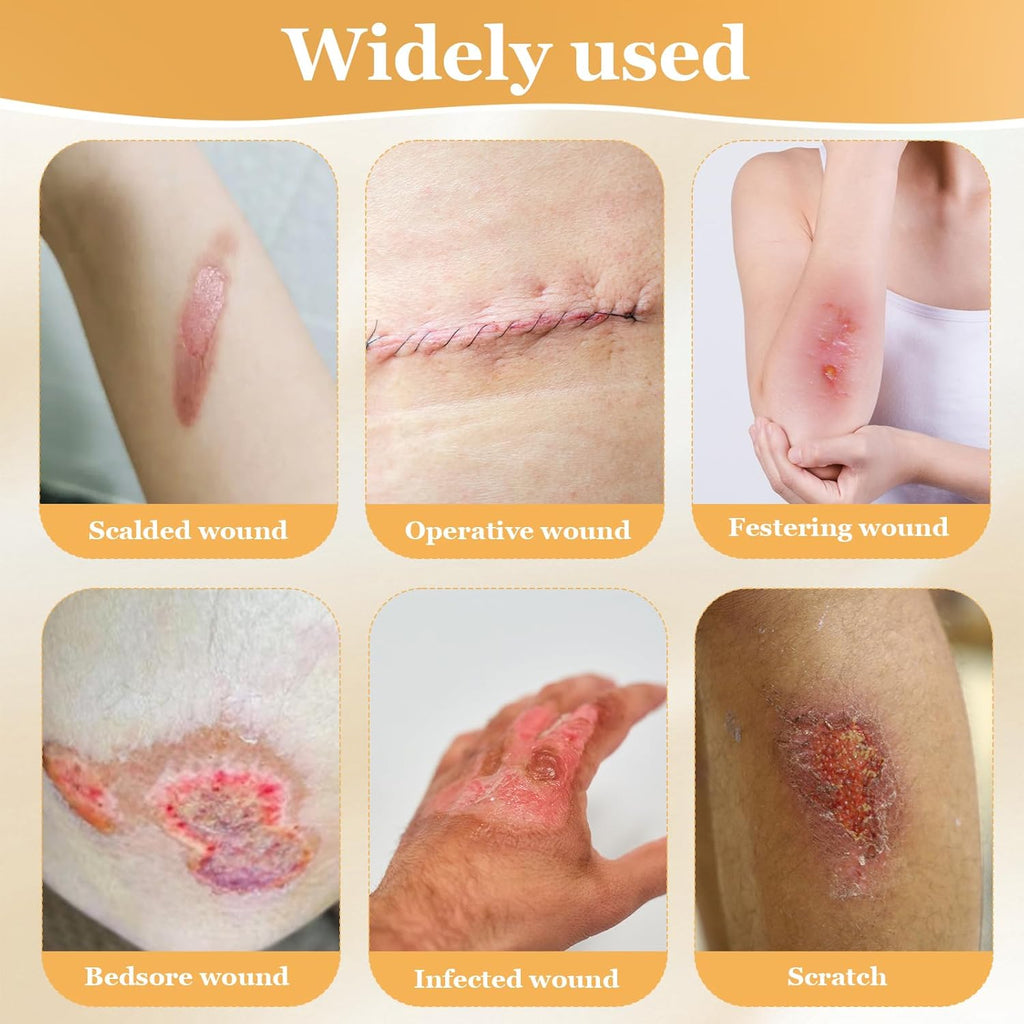KASTWAVE 5 Gauze and Wound Dressings Silicone High Absorbency 5 pieces 10 cm
