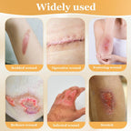 KASTWAVE 5 Gauze and Wound Dressings Silicone High Absorbency 5 pieces 10 cm