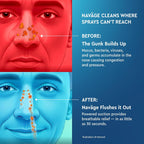 NAVAGE® Starter Bundle: Nose Cleaner, 30 SaltPods, Congestion Relief | Complete Sinus Care Kit: Powered Nasal Irrigation System w/ 30 Pre-Measured SaltPods for Clinically Proven Benefits