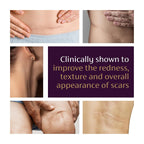 Mederma Advanced Scar Gel - Treats Old & New Scars, Reduces Appearance of Scars from Acne, Surgery, Burns, Injury & Stretch Marks, 0.70 Oz (20g)