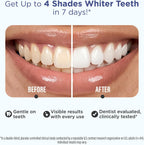 GuruNanda Teeth Whitening Strips Kit - 7-Day Treatment with Non-Slip, Dry Strip Technology - Whitening Designed with Care for a Brighter Smile