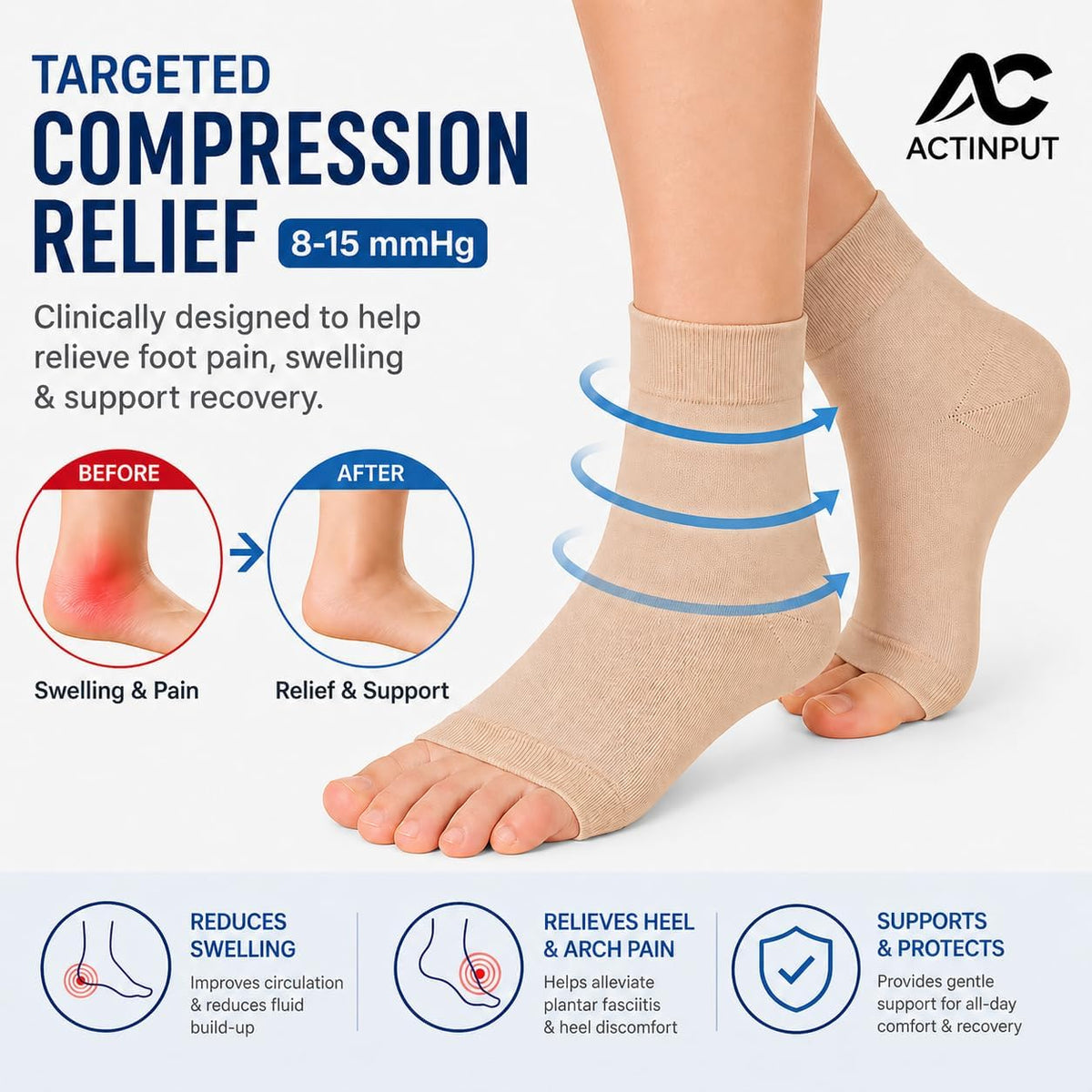 Ankle Brace Compression Sleeve Socks 2 Pack for Women&Men Foot Arch Support | 8-15 mmHg Support for Plantar Fasciitis Relief, Heel Pain, Arch & Ankle Support, Foot Brace, Open Toe Design?Beige S/M?