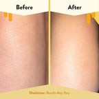 ECZEMA HONEY Soothing Body Wash, Daily Shower Gel & Eczema Care (13 Oz) | Body Cleanser for Eczema reatmenttreatme, Sensitive Skin Body Wash for Adults, Kids, & Babies