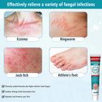 Antifungal Treatments 30 g