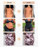SHAPELLX Fajas Colombianas Shapewear for Women Tummy Control Plus Size Postpartum Body Shaper Butt Lifting Bodysuit