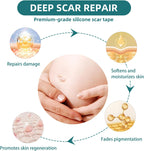 Silicone Scar Tape for Surgical Scars: Medical Grade Scar Gel Sheets for C-Section Tummy Tuck Recovery and Treatment – Reusable Scar Strips for Keloid Burn Acne Scars Removal (1.6'' x 60''Roll-1.5M)