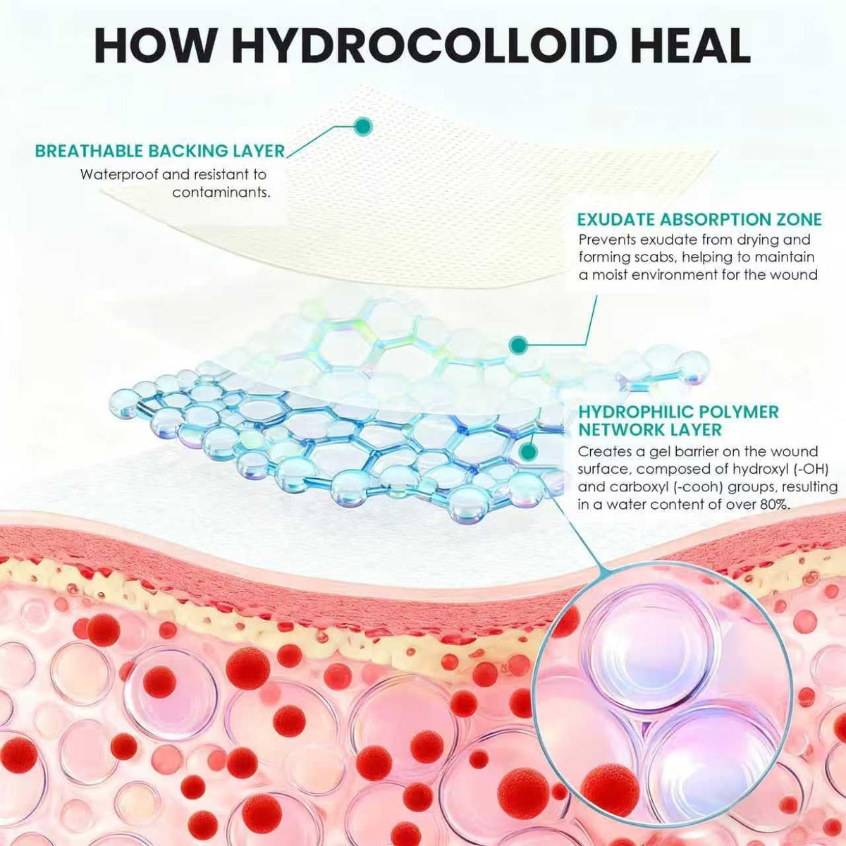 Medical-Grade Hydrocolloid Roll for Wound Care: 5cm × 3.6m Hydrocolloid Bandages, Cut-to-Size Self-Adhesive Patch Dressing, Waterproof & Ultra Absorbent Tape for Burns, Blisters, Acne, First Aid Kit