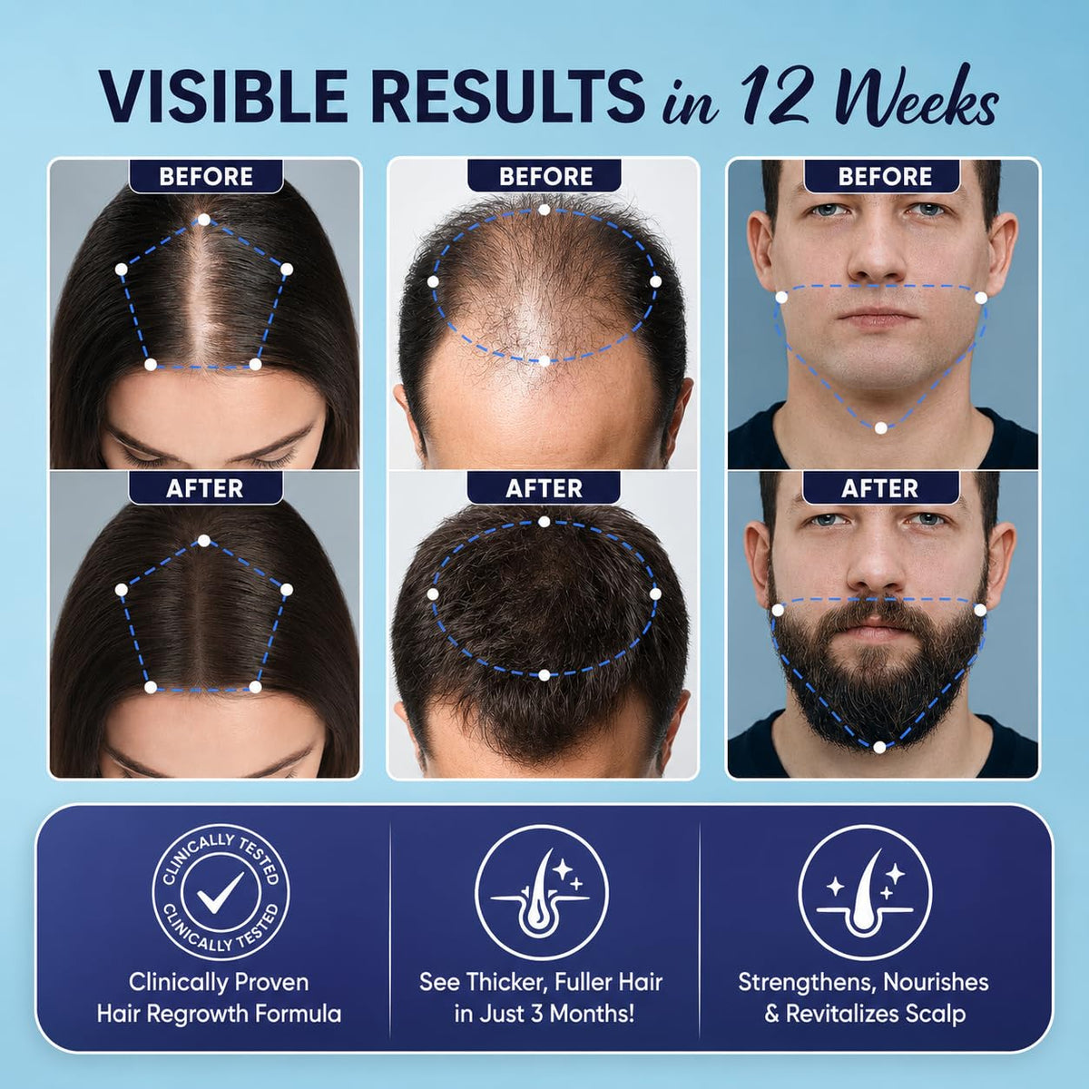 5% Minoxidil for Men and Women Hair Growth: Minoxidil Spray Hair Regrowth Treatment Serum with Biotin & Rosemary -Stop Hair Thinning and Hair Loss For Stronger Thicker Longer Hair 2 Pack