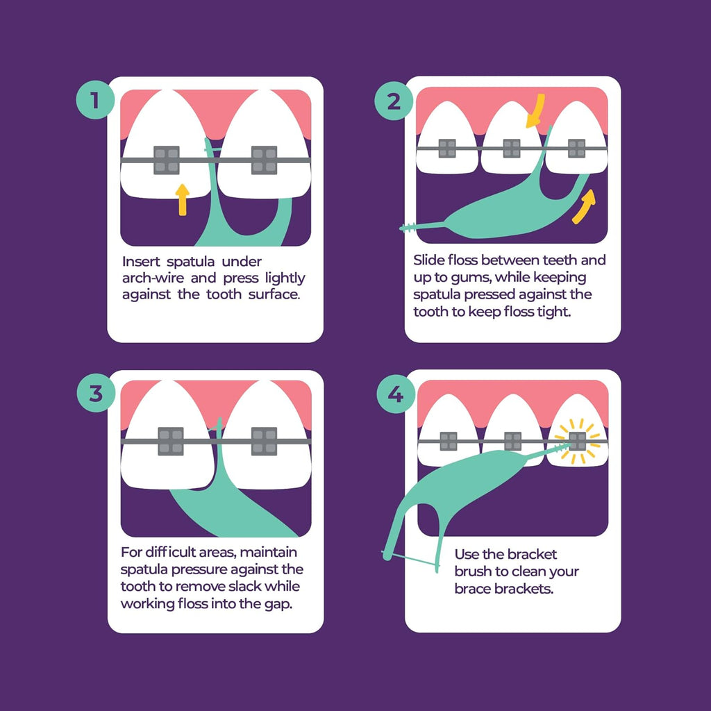 Platypus Orthodontic Flossers for Braces, 40 Count (Pack of 1) | Suitable for Adults & Kids; Fits Under Arch Wire, Non-Damaging & Encourages Flossing; Floss Teeth in Under Two Minutes