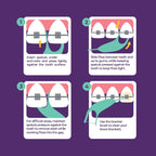 Platypus Orthodontic Flossers for Braces, 40 Count (Pack of 1) | Suitable for Adults & Kids; Fits Under Arch Wire, Non-Damaging & Encourages Flossing; Floss Teeth in Under Two Minutes
