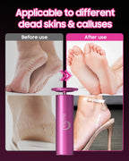 HayZBao FSA&HSA Electric Foot Callus Remover - Callus Remover for Feet,Professional Pedicure Tool for Dead Skin,Electric Foot File with 60 Pcs Sandpaper Discs - Pink