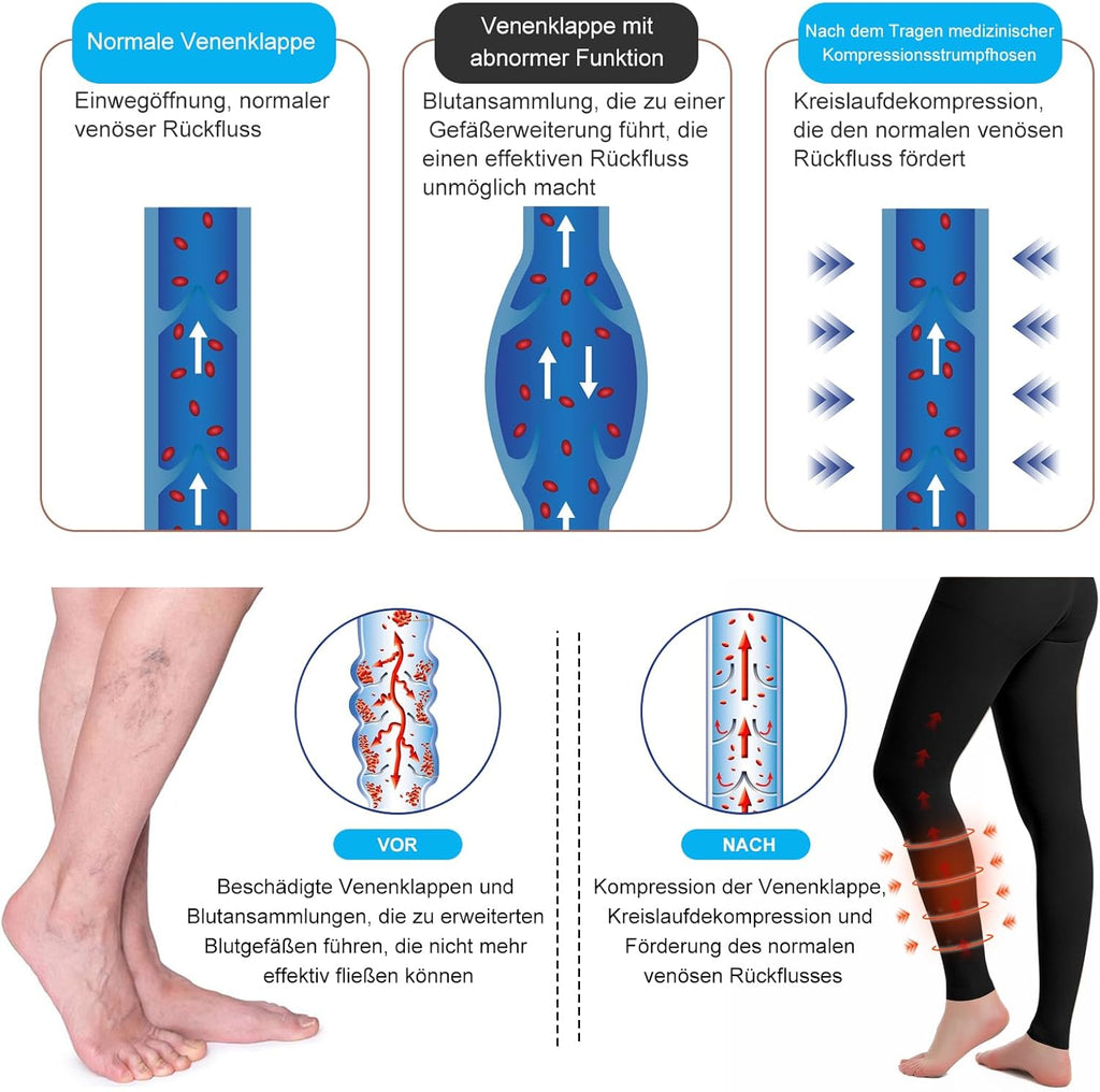 Compression Socks 30 mm