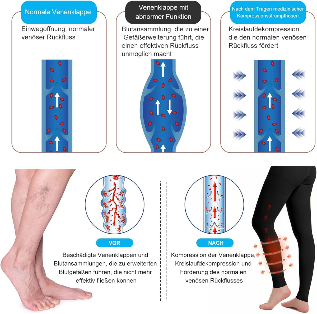Compression Socks 30 mm