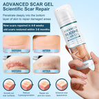 Mitgary Advanced Scar Gel, Silicone Scar Gel, Treats Old and New Scars, Reduces the Appearance of Scars from, Body, Face, Stretch Marks, Surgical Scar, Keloids, Acne, Burns and More, 50g (1.7 Oz)