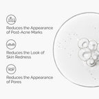 The Ordinary Aloe 2% + NAG 2% Solution, Soothes Skin and Targets Post-Acne Marks, 1 Fl Oz