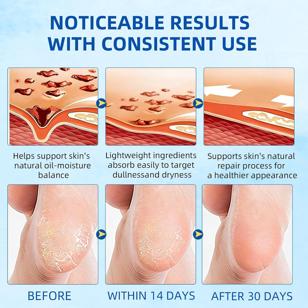 60% Urea Foot Cream Stick with 2% Salicylic Acid, Maximum Strength Urea Foot Cream Callus Remover for Dry Cracked Heels, Hands, Knees, Elbows, Dead Skin Remover Foot Balm 1.41oz