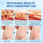 60% Urea Foot Cream Stick with 2% Salicylic Acid, Maximum Strength Urea Foot Cream Callus Remover for Dry Cracked Heels, Hands, Knees, Elbows, Dead Skin Remover Foot Balm 1.41oz