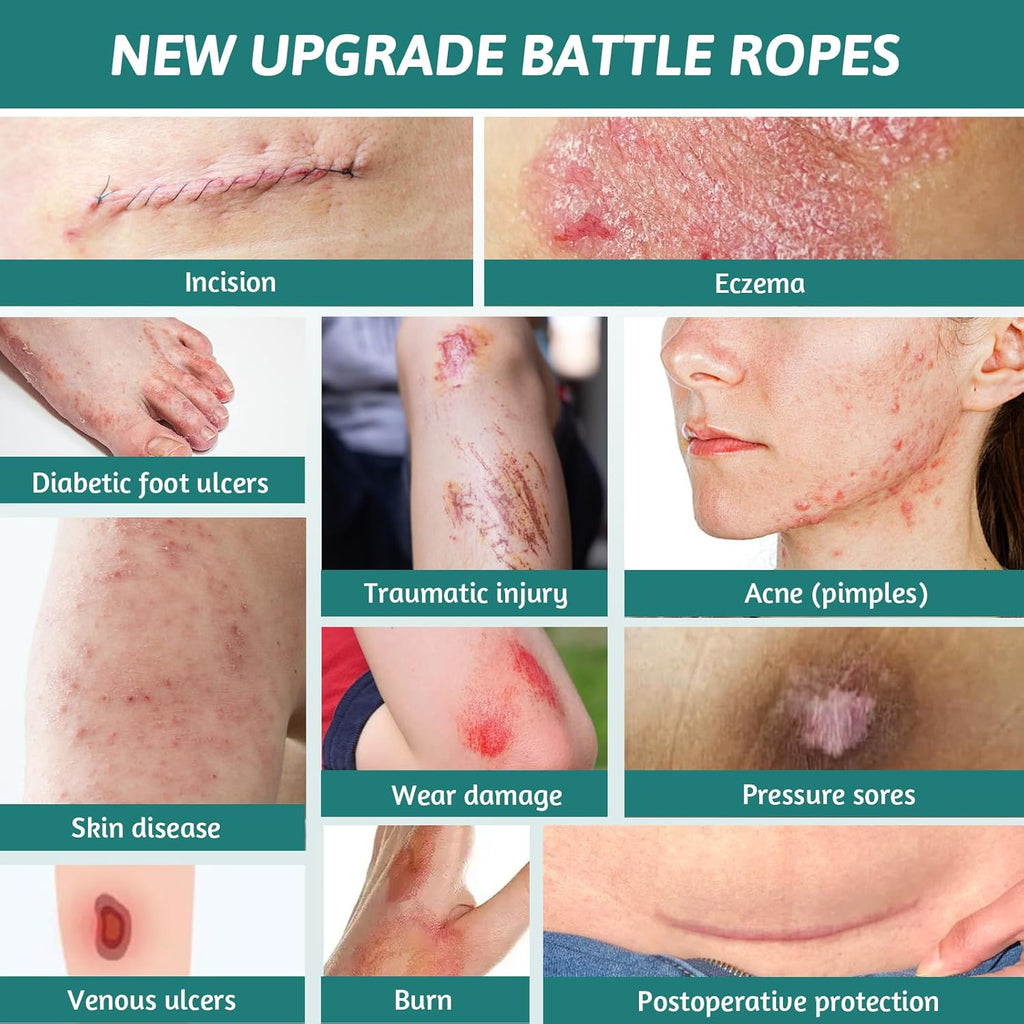 Hydrocolloid Wound Care Bandages