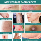 Hydrocolloid Wound Care Bandages