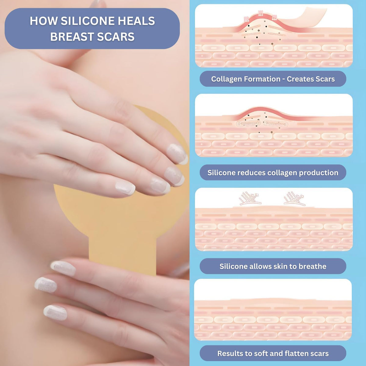 Bras Silicone 4 pieces