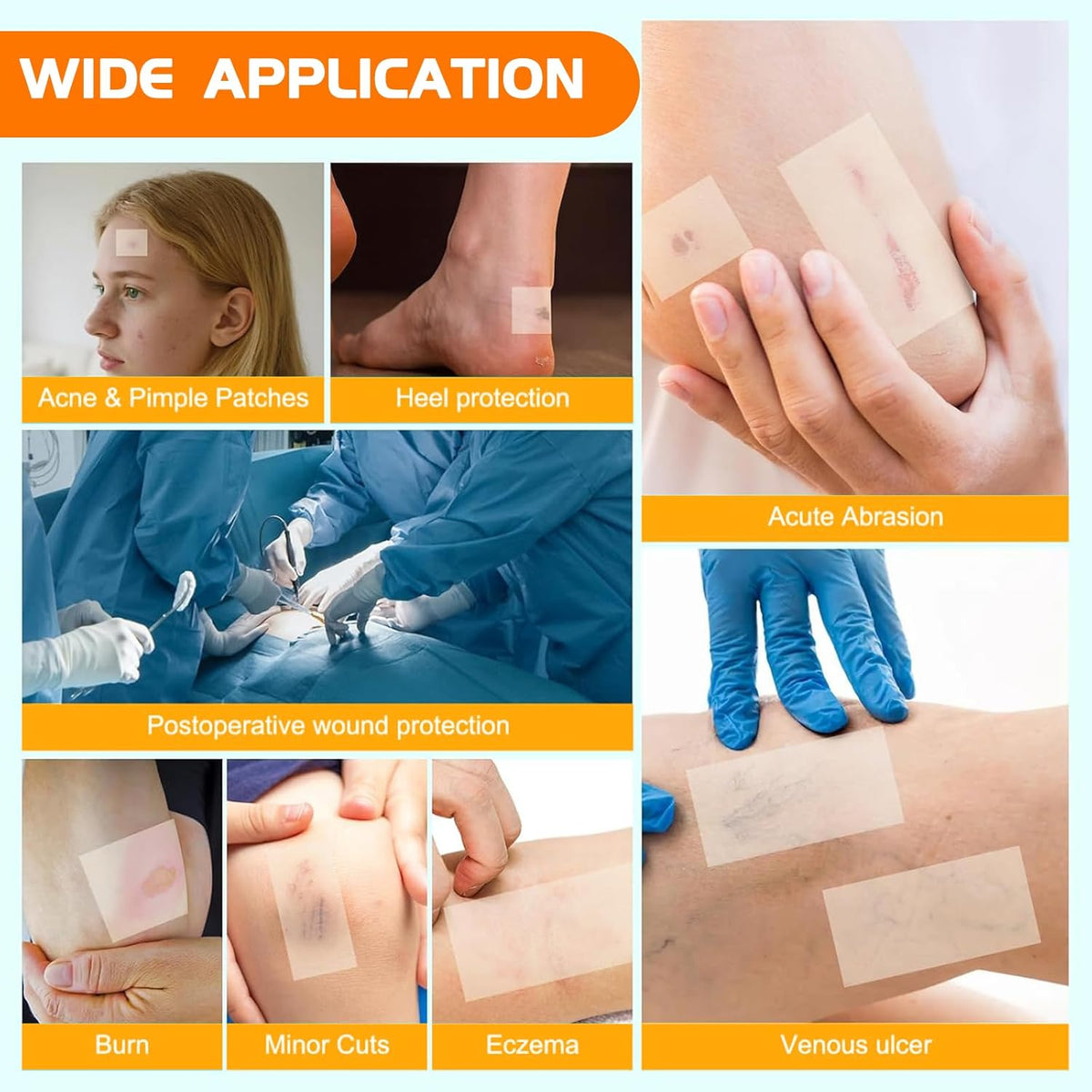 Hydrocolloid Roll for Wound Care, 2in x 4.8ft Self-Adhesive Hydrocolloid Bandages, Cut-to-Size, Waterproof & Ultra Absorbent, for Burns, Acne, Blisters, Cuts, and Post-Surgical Care