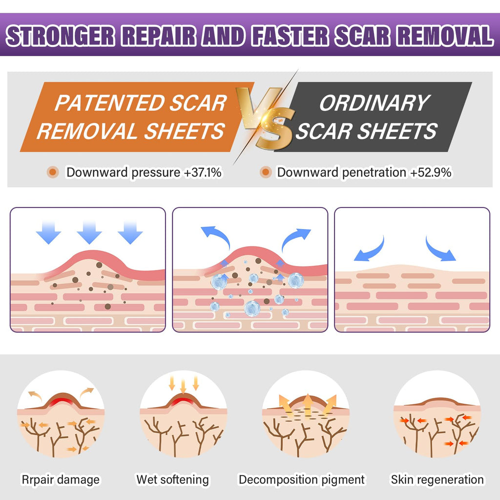 Silicone Scar Sheets, Medical Grade Silicone Scar Tape for Old & New Scars | Scar Tape for Surgical, Hypertrophic, Keloid, C-Section, Burn Scars, Reusable Professional Scars Removal (1.6"X59" Roll-1.5M)