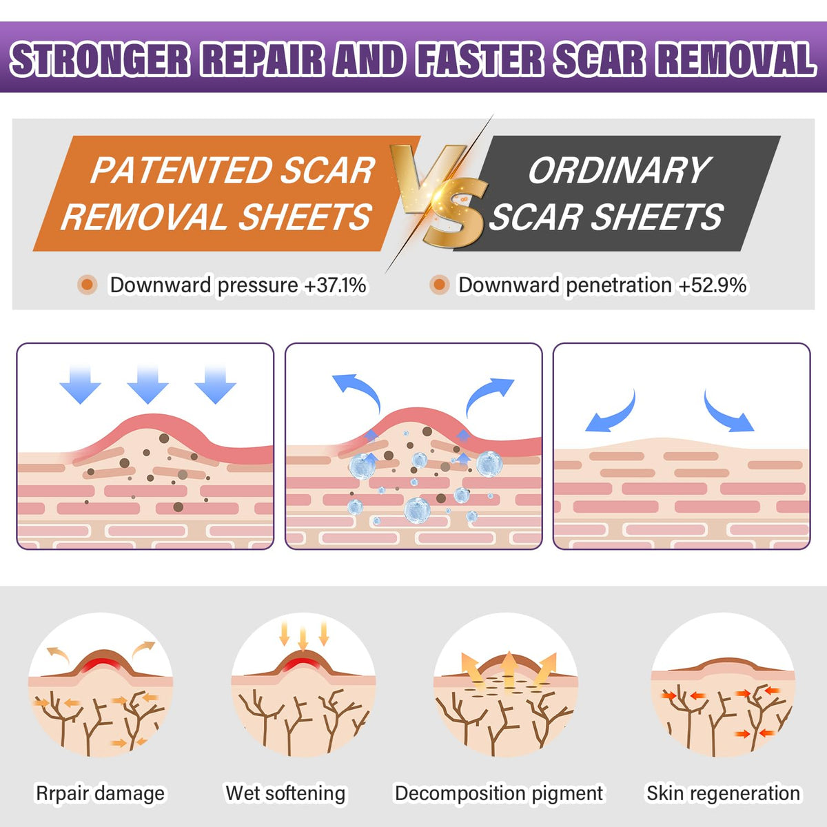 Silicone Scar Sheets, Medical Grade Silicone Scar Tape for Old & New Scars | Scar Tape for Surgical, Hypertrophic, Keloid, C-Section, Burn Scars, Reusable Professional Scars Removal (1.6"X59" Roll-1.5M)