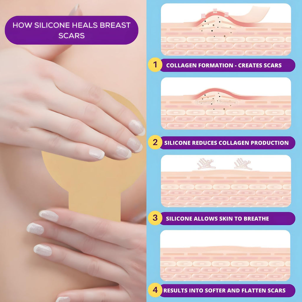 Breast reduction must haves Post Surgery scar tape - Breast Augmentation recovery supplies after surgery needs - Post Op Silicone scar sheets for surgical scars - Comfortable under Post Op Bra