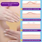 Breast reduction must haves Post Surgery scar tape - Breast Augmentation recovery supplies after surgery needs - Post Op Silicone scar sheets for surgical scars - Comfortable under Post Op Bra