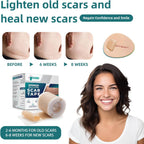 Silicone Scar Tape for Surgical Scars: Medical Grade Scar Gel Sheets for C-Section Tummy Tuck Recovery and Treatment – Reusable Scar Strips for Keloid Burn Acne Scars Removal (1.6'' x 60''Roll-1.5M)