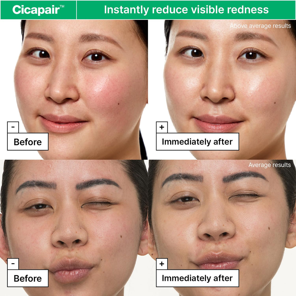 Dr.Jart+ Cicapair Sensitive Skin Korean Face Moisturizer for Redness and Barrier Repair with Centella Asiatica | Korean Skin Care