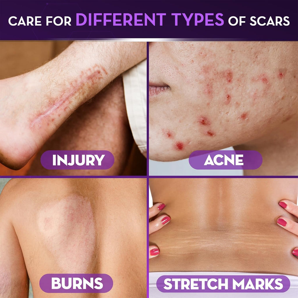 Cicatricure Advanced Scar Gel, Proven Results in 2 Weeks, 1 oz (28 g) | Scar Gel for Face & Body, Scar Treatment for Surgical Scars, Stretch Marks, Scars of Burns and Injuries, Acne Scar Treatment