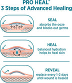 BAND-AID Brand Pro Heal Adhesive Bandages, Extra Large, 5 Count