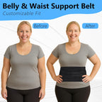Umbilical Hernia Belt for Men & Women – Adjustable Abdominal Binder with 2 Compression Pads for Belly Button, Ventral, Incisional & Epigastric Hernias, Core Support & Post Surgery Recovery