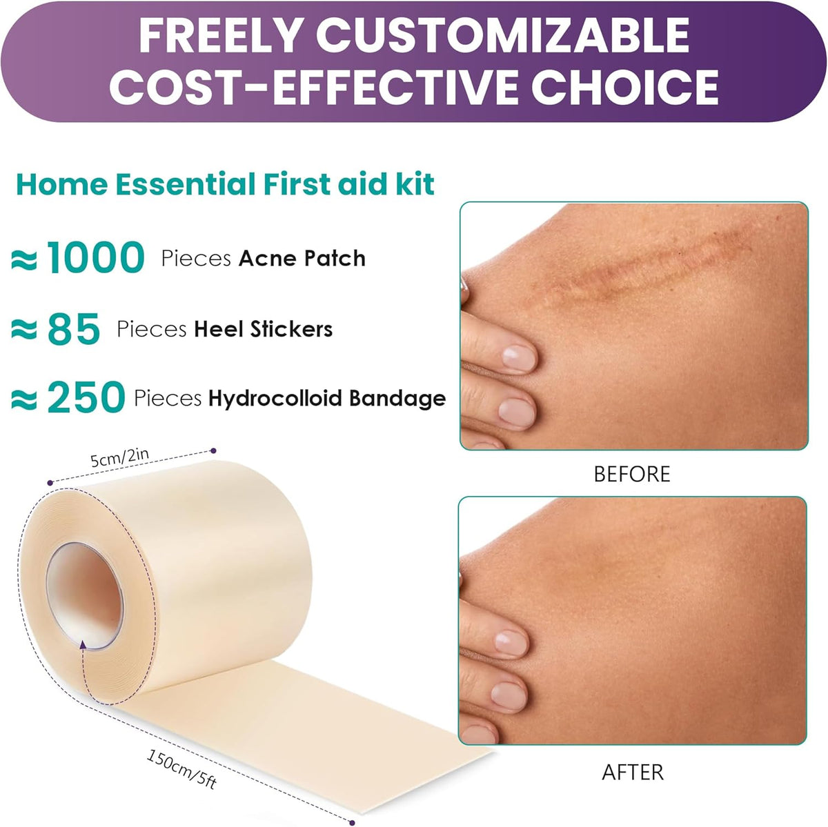 Medical-Grade Hydrocolloid Roll for Wound Care: 5cm × 1.5m Hydrocolloid Bandages, Cut-to-Size Self-Adhesive Patch Dressing, Waterproof & Ultra Absorbent Tape for Burns, Blisters, Acne, First Aid Kit