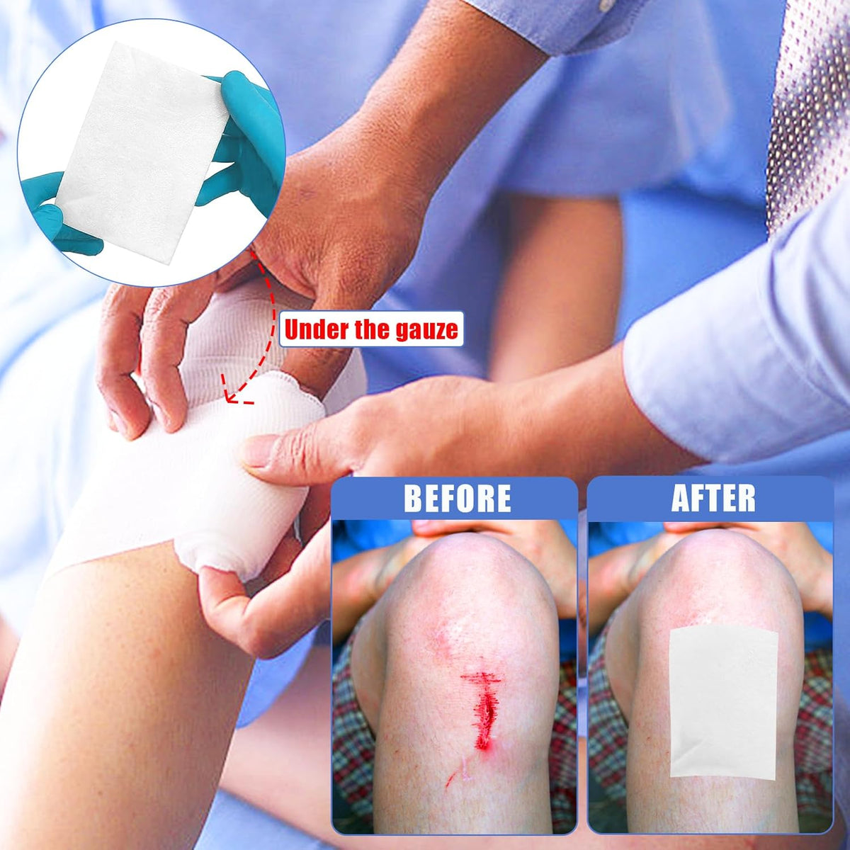 Non-Stick Wound Dressing Pads, 5 CM x 7.5 CM, Pack of 10, Sterile Highly Absorbent Wound Care Individually Wrapped Dressings